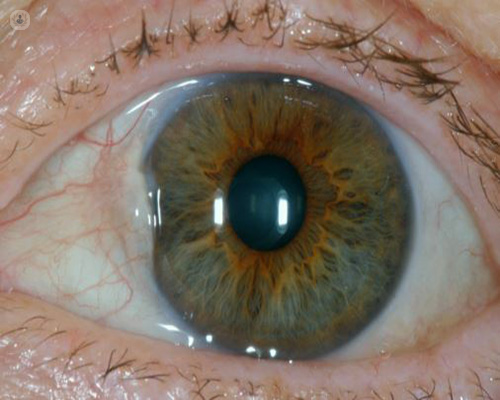 Tratamiento de las enfermedades de la retina con inyecciones intravítreas ¿qué son?